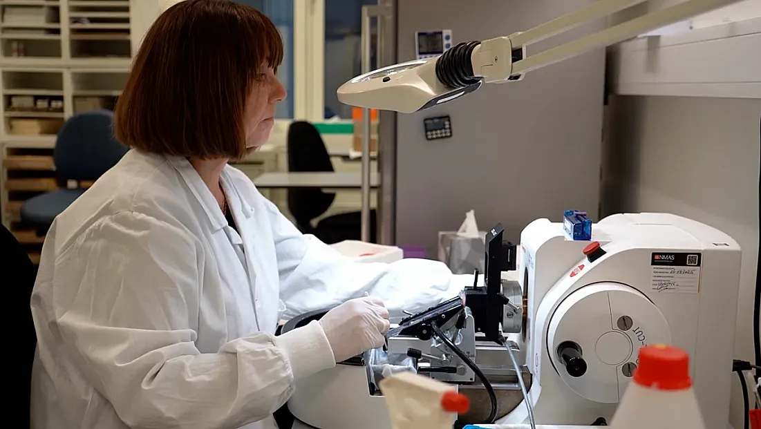 Yapay Zeka Kanser Tedavisinde Kişiye Özel Yaklaşımı Yeniden Şekillendiriyor