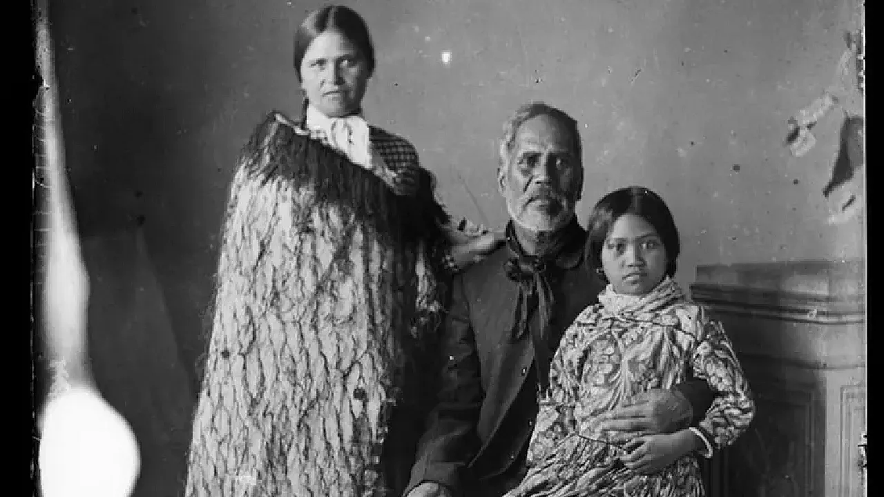 Kanseri Gelmeden Durduran Radikal Karar Midesiz Bir Hayat Mümkün mü?