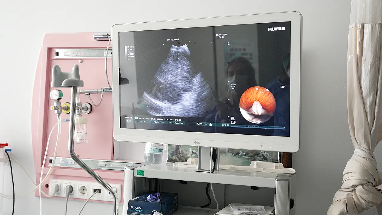 Malatya'da Akciğer Tanısında Yeni Dönem!