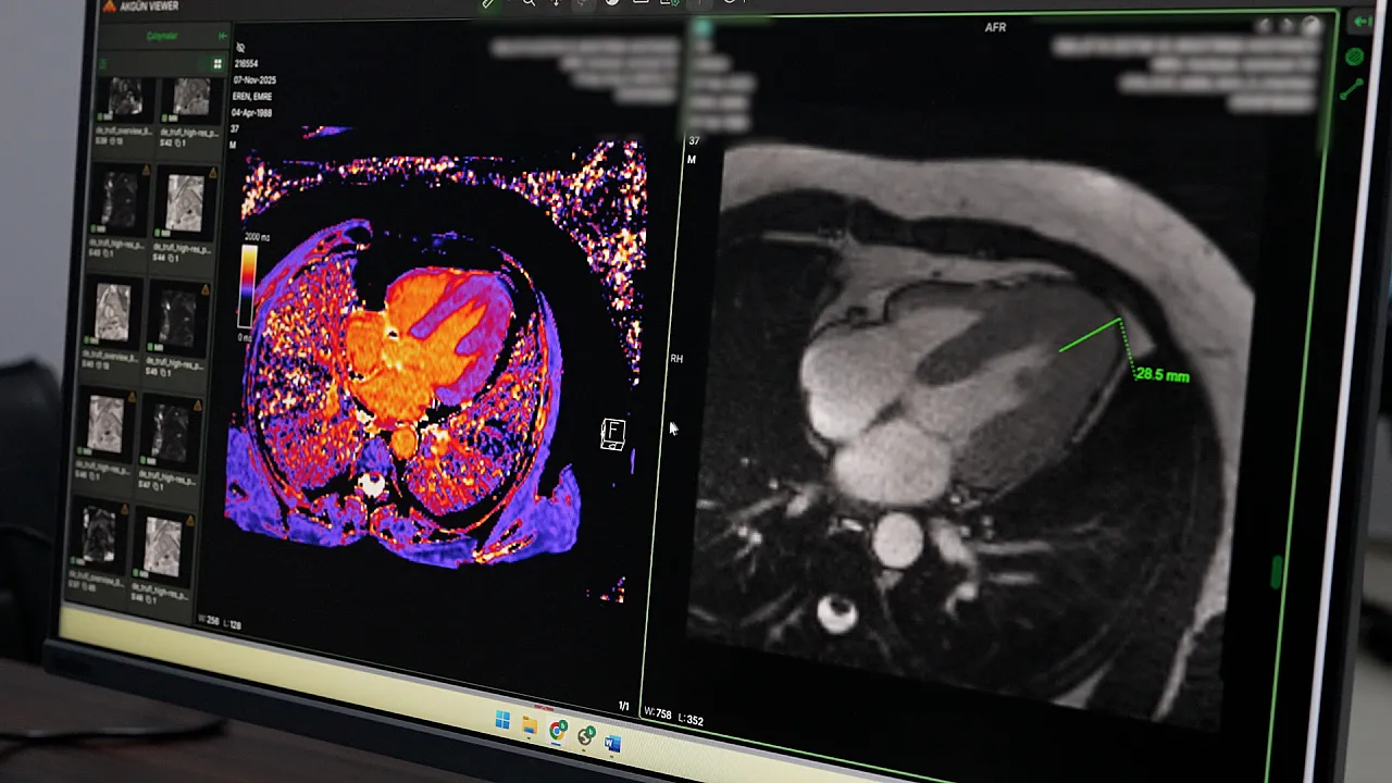 Malatya'da Sağlıkta Devrim! İleri Radyolojik Tetkikler Dönemi Başladı