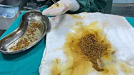 Bingöl'de Tıp Dünyasını Şaşırtan Ameliyat!