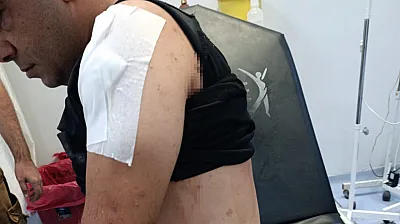 İş görüşmesine gitti, canından oluyordu