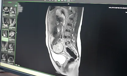 Malatya'da Sağlıkta Devrim! İleri Radyolojik Tetkikler Dönemi Başladı