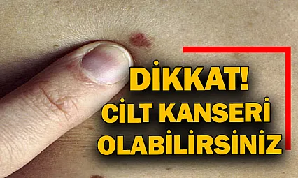 Dikkat! Cilt kanseri olabilirsiniz