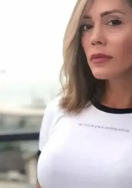 Didem Ceran'ın Yüz Nakli Sonrası Şaşırtan Detay: Kaşında Saç Çıktı