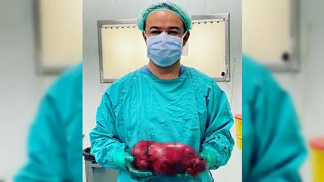 Korona virüs sayesinde 30 santimlik tümöründen kurtuldu