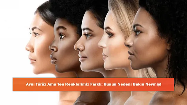 Aynı Türüz Ama Ten Renklerimiz Farklı: Bunun Nedeni Bakın Neymiş!