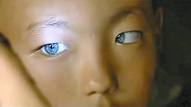 Çocuklarda Sakarlık Sanılan Belirti Tavuk Karası Olabilir!