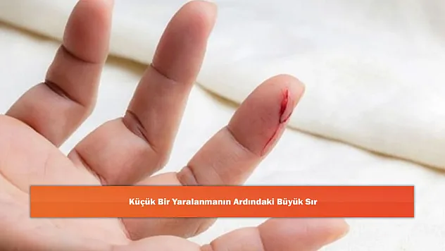 Küçük Bir Yaralanmanın Ardındaki Büyük Sır