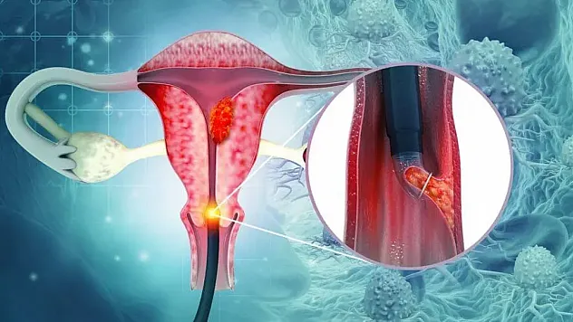 Rahim Ağzı Kanseriyle Mücadelede Erken Teşhis ve Aşılama Hayat Kurtarıyor