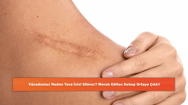 Vücudumuz Neden Yara İzini Silmez? Merak Edilen Sebep Ortaya Çıktı!