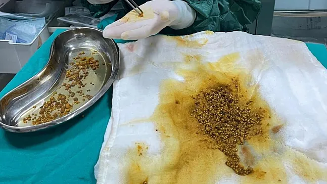 Bingöl'de Tıp Dünyasını Şaşırtan Ameliyat!