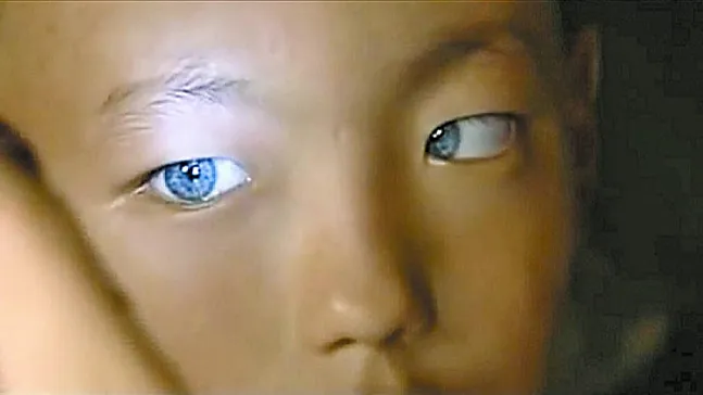 Çocuklarda Sakarlık Sanılan Belirti Tavuk Karası Olabilir!