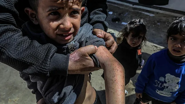 Gazze'de Salgın Alarmı: Kemirgen Tehdidi Milyonlarca Yaşamı Kuşattı!