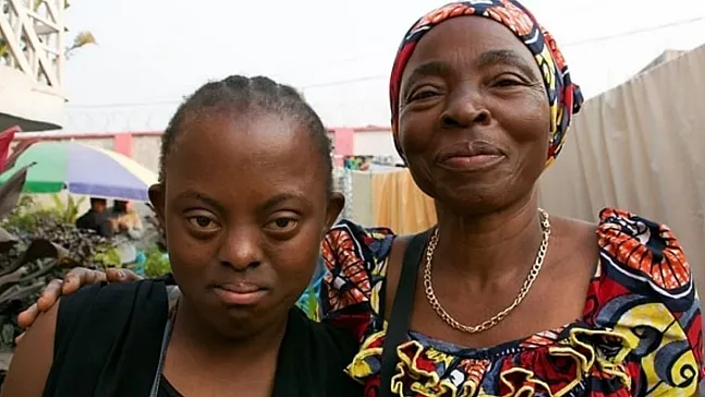 Genetik Gerçeklerin Gölgesinde Kalan Siyahi Down Sendromlu Kişilerin Görünmezlik Mücadelesi