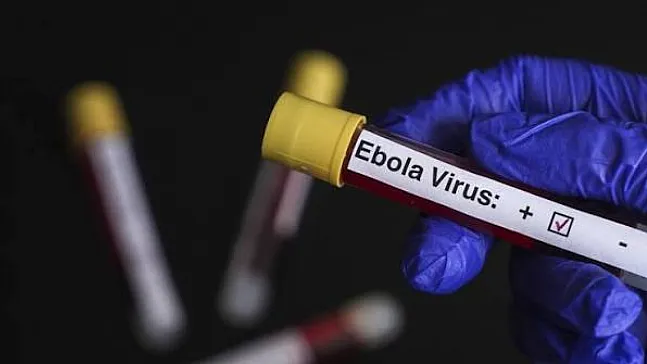 Kenya'da İlk Ebola Vakası! Hasta Hayatını Kaybetti