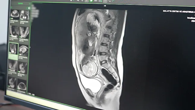Malatya'da Sağlıkta Devrim! İleri Radyolojik Tetkikler Dönemi Başladı