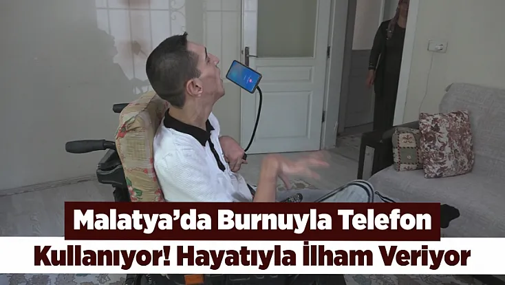 Malatya’da Burnuyla Telefon Kullanıyor! Hikayesi Dikkat Çekiyor
