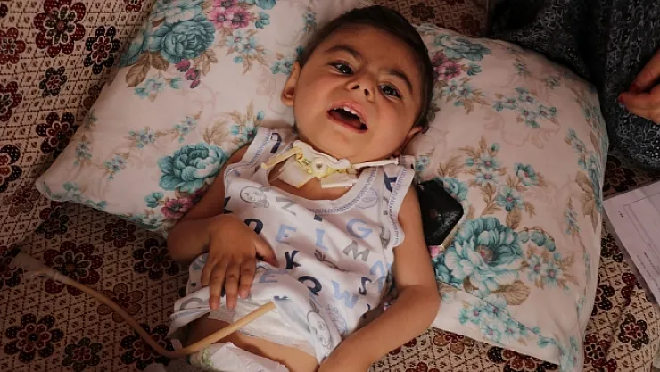 Küçücük bedeni ile yaşam savaşı veriyor!