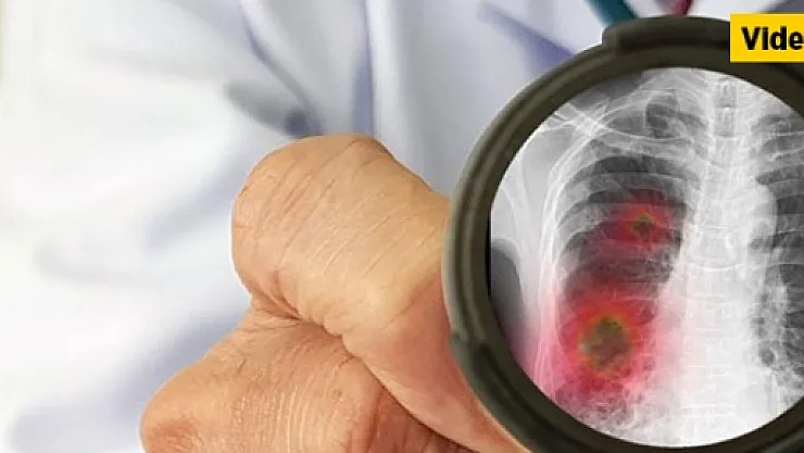 İşte Corona Virüsten korunmanın yolları!..