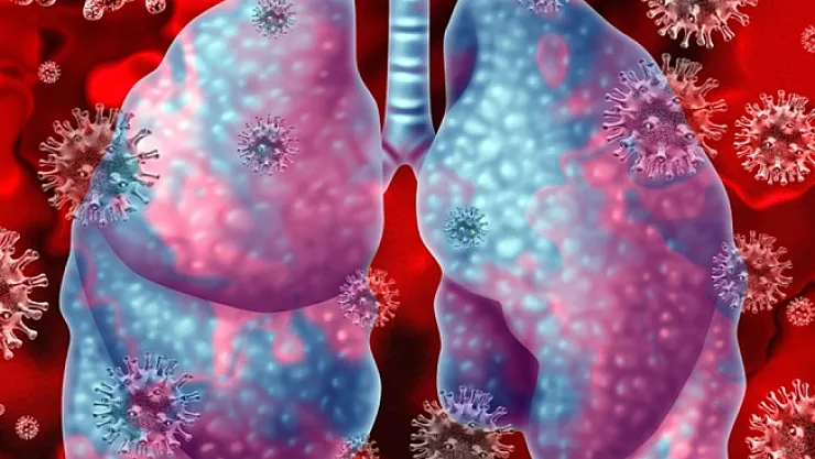 Türkiye'de can kaybı 725'e yükseldi!