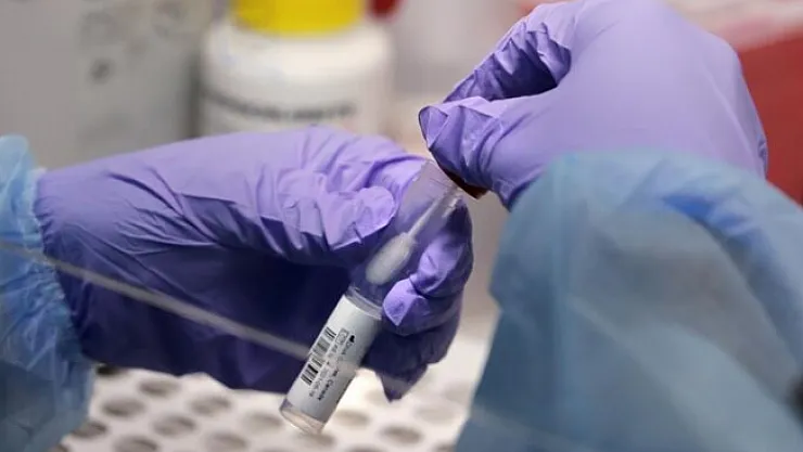 Korona virüste korkutan gelişme! Vaka sayısı artışa geçti!