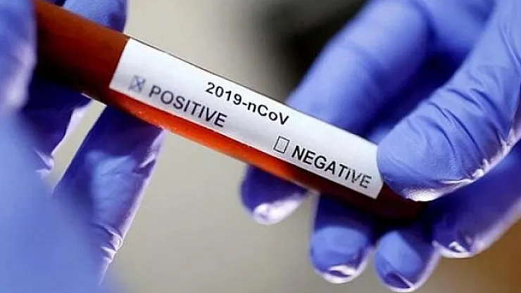 Malatya'da Covid-19 hastalarını artık o 3'lü ekip takip edecek!