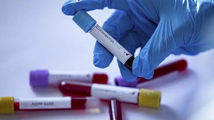 Yeni Malatyaspor'da Covid 19 vakası tespit edildi!