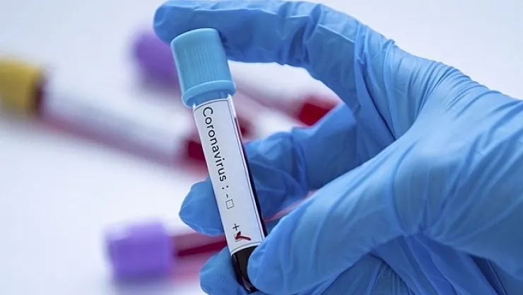 Yeni Malatyaspor'da vaka sayısı 6'ya yükseldi