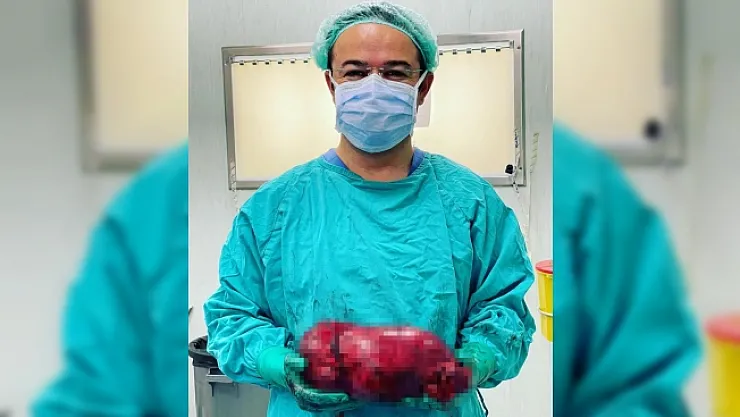 Korona virüs sayesinde 30 santimlik tümöründen kurtuldu