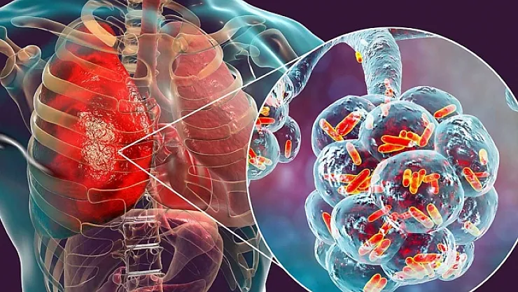 Türkiye'de yeni salgın alarm veriyor