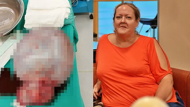 İngiliz hastanın karnından 6 kilogram kitle çıkarıldı