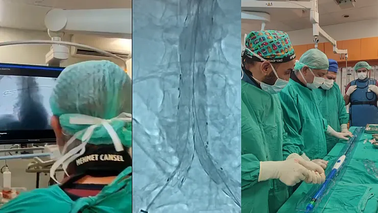 78 Yaşındaki Hastaya Kapalı Yöntemle Aort Onarımı