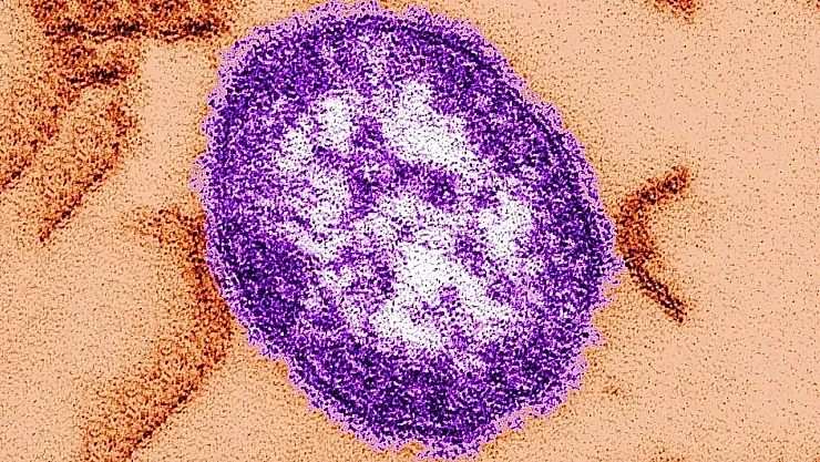 ABD'de Kızamık Salgını Yeniden Yayılıyor