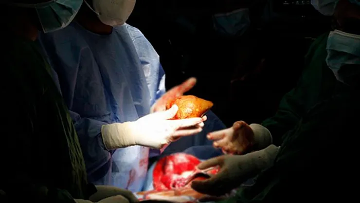 ABD'de Organ Naklinden Sonra Kuduz Ölümü