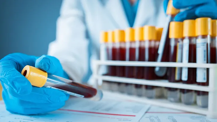 Basit Kan Testi Hastalıkları 10 Yıl Önceden Gösteriyor! Bilim Dünyasında Yeni Dönem