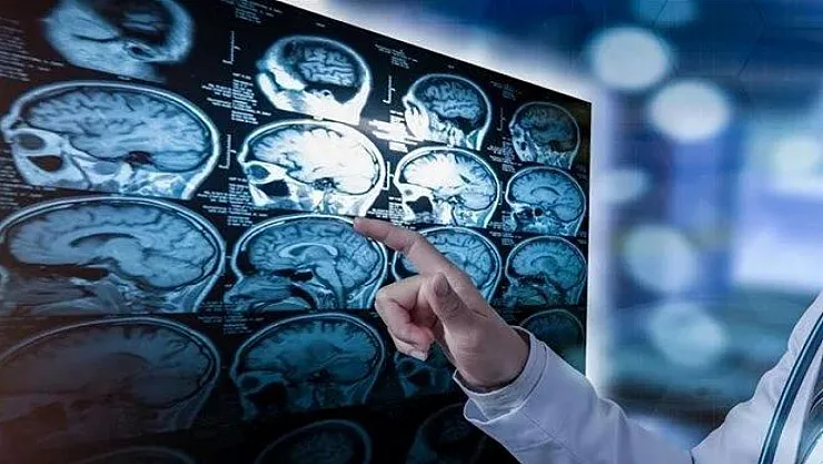 Beyin anıları yeniden yazıyor
