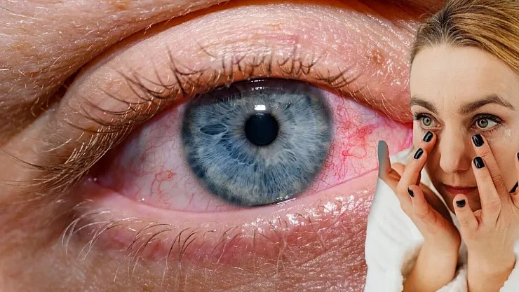 Dikkat! Kış Mevsimi Göz Sağlığını Tehdit Ediyor!