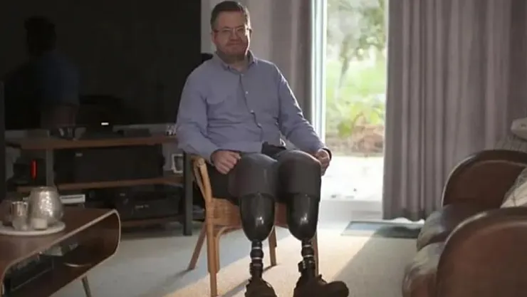 İngiltere'de şok eden dolandırıcılık: Cerrah kendi bacaklarını kestirip sigorta aldı