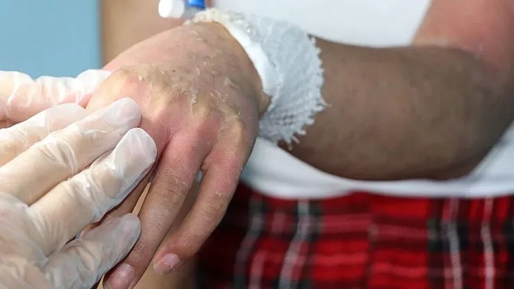 Kezzap Gibi Krem: 'Bir Krem İnsanını Yoğun Bakımlık Edebilir'