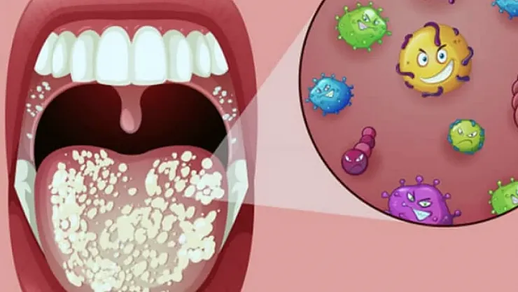 Kocaeli'de Bilim İnsanlarından Çarpıcı Uyarı: Ağızdaki Mikroplar Kalbe Kadar Ulaşıyor, Ciddi Hastalıkları Tetikleyebilir