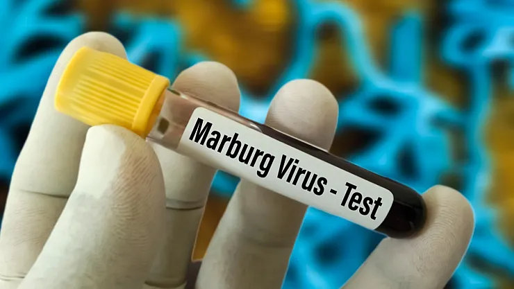 Ölümcül Tehlike: Marburg Virüsü Kongo'da Ortaya Çıktı, Dünya Alarmda