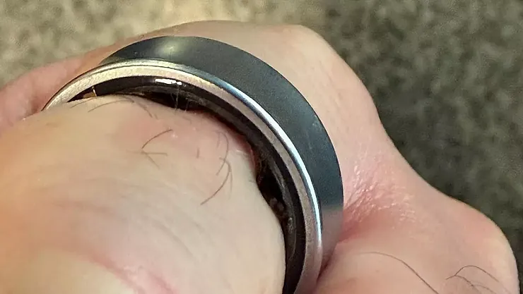 Samsung Galaxy Ring Kullanıcısının Parmağında Şişti: Hastanede Zorla Çıkarıldı