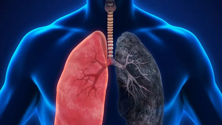 Nefes Darlığını Hafife Almayın: KOAH Olabilir