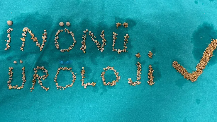 72 Yaşındaki Hastadan 200'ün Üzerinde Mesane Taşı Çıkarıldı