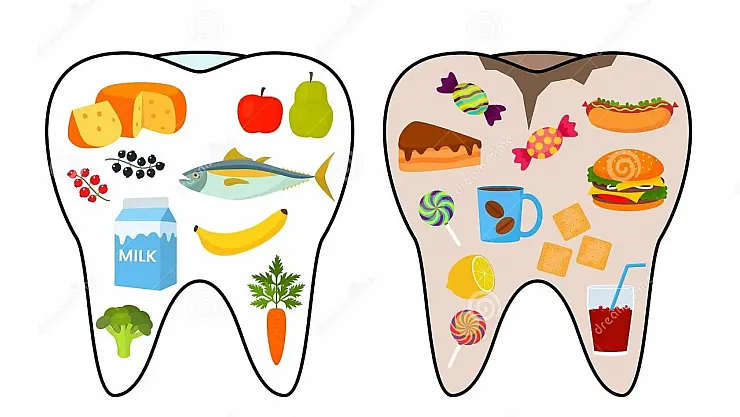 Uzmanlar Uyarıyor: Diş Çürüklerinin Gizli Nedeni Paketli Gıdalar ve Şekerli İçecekler!