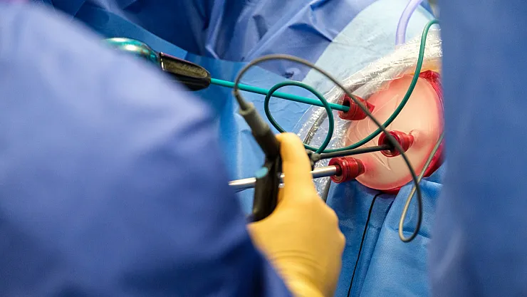 V-NOTES Tekniği ile 50 Hasta Şifa Buldu