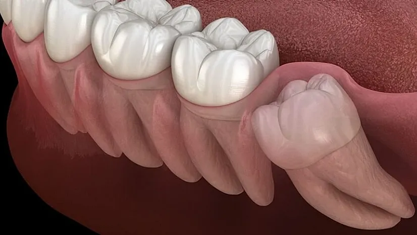 Geleceğin Sağlık Anahtarı Olan Yirmilik Dişler Kalp Dokusunu Yenileme Potansiyeliyle Tıp Dünyasını Sarsıyor