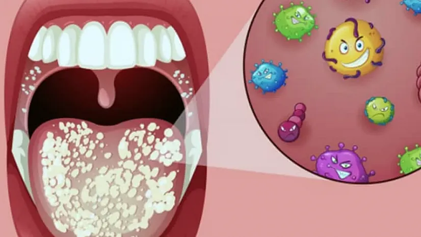 Kocaeli'de Bilim İnsanlarından Çarpıcı Uyarı: Ağızdaki Mikroplar Kalbe Kadar Ulaşıyor, Ciddi Hastalıkları Tetikleyebilir